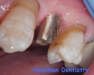 Hackman Dentistry Atlanta, Ga 30328