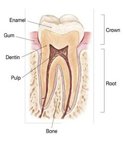 Cracked or Fractured Teeth - Timothy P. Resuta DMD & Associates